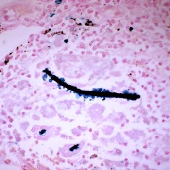 asbestos fiber and macrophages